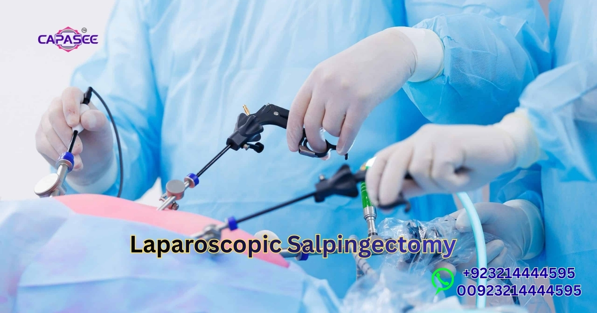 Laparoscopic Salpingectomy