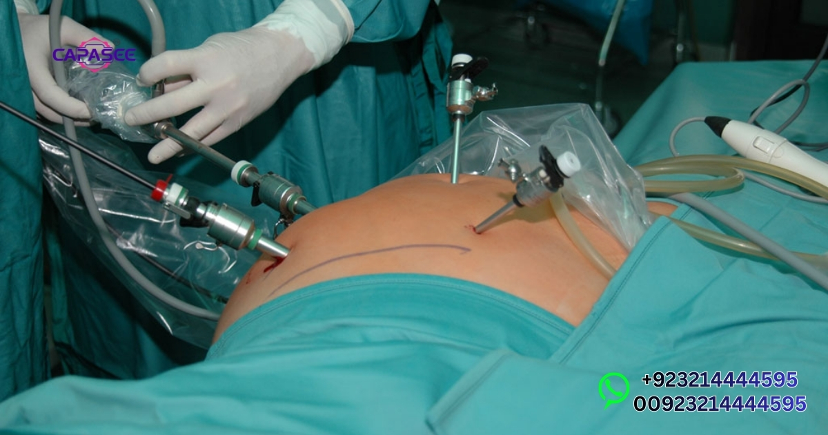 Top Procedures Pakistan