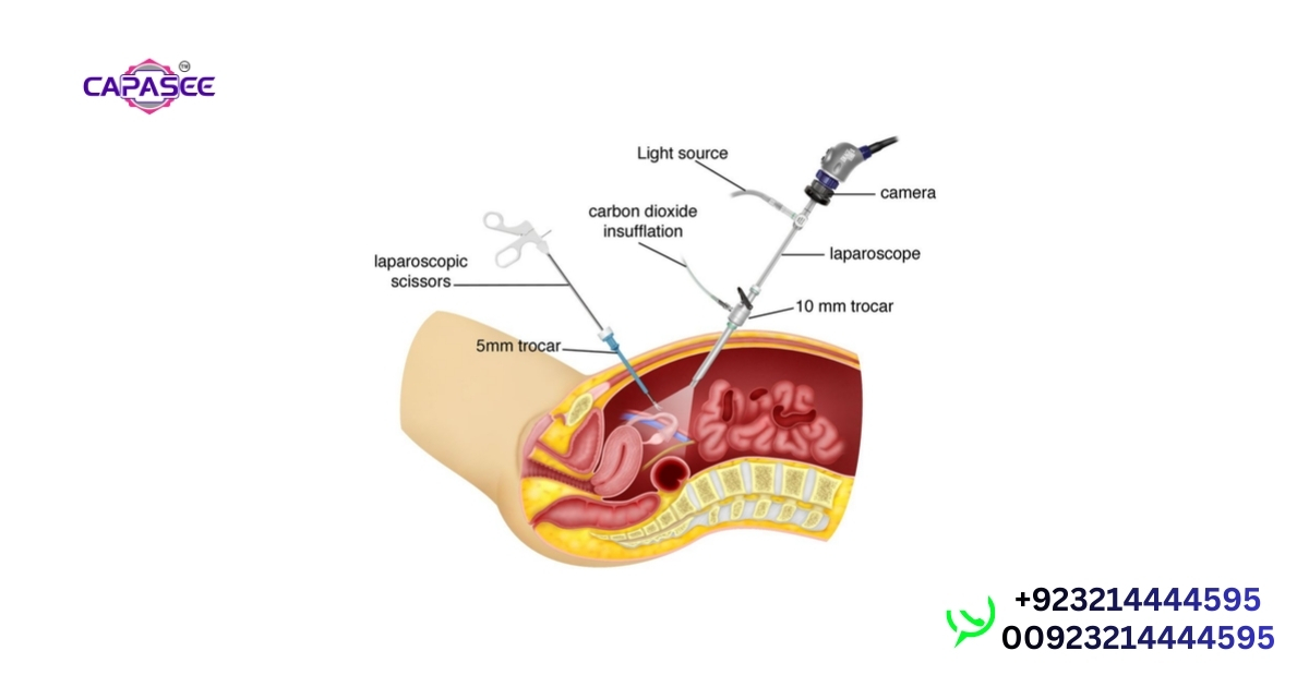 Benefits & Risks of Laparoscopic Hysterectomy