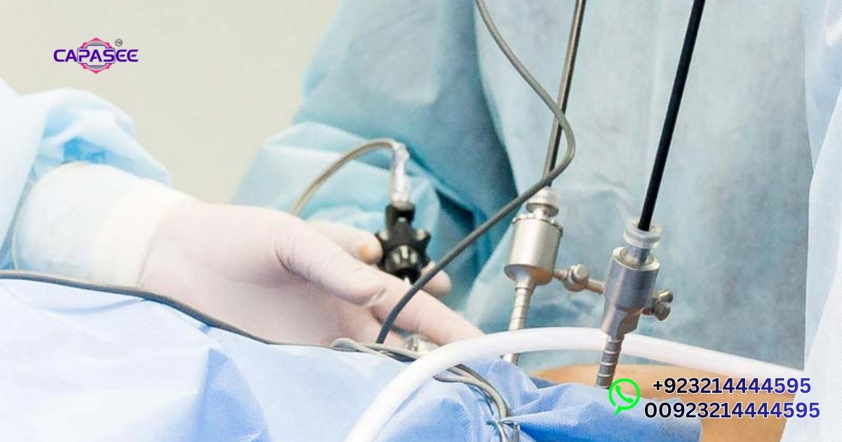 Benefits of 4 Port Laparoscopic Surgery