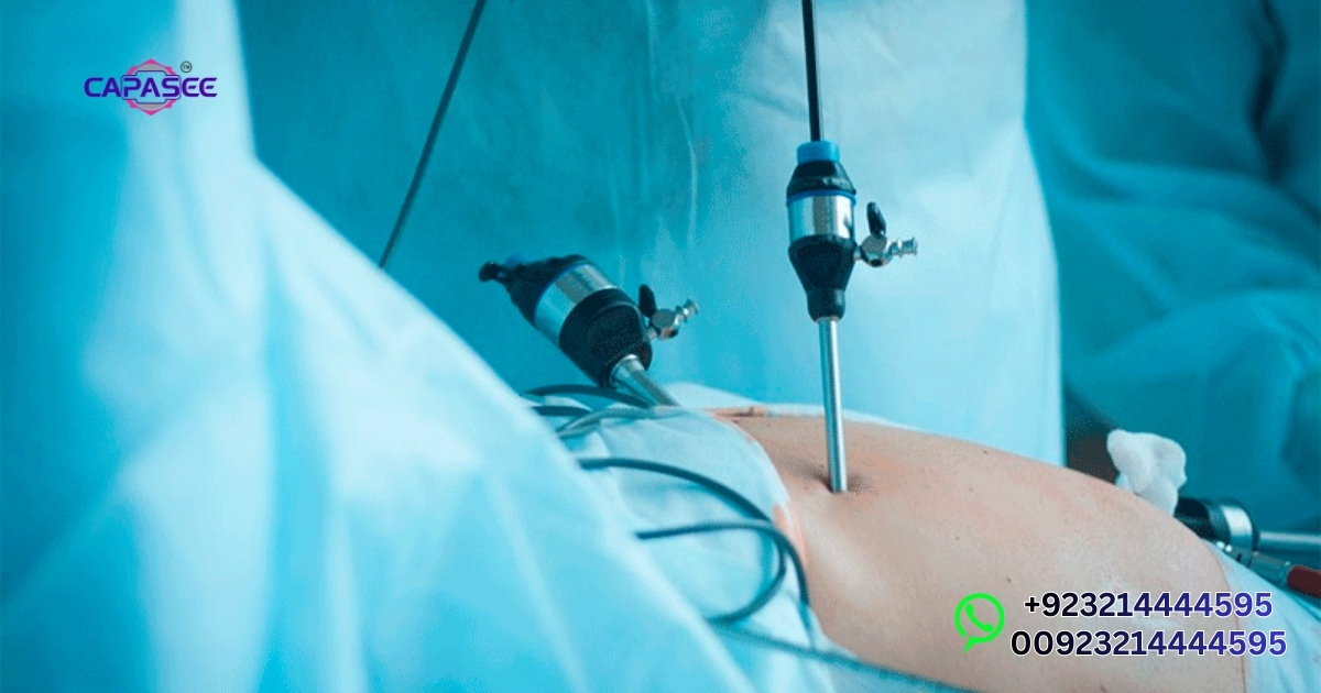 Capasee Guide to Safe Laparoscopy Recovery