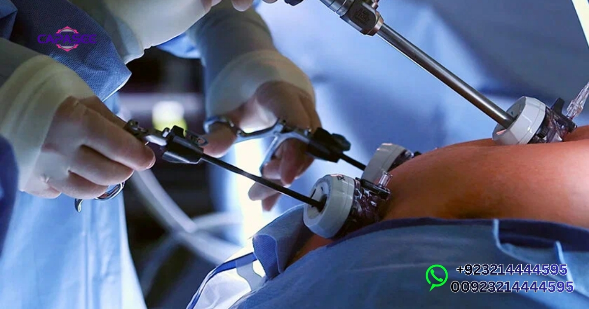 Capasee Treatment Pakistan