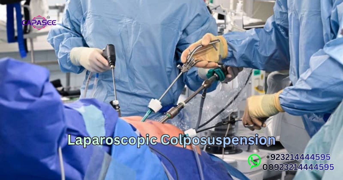 Laparoscopic Colposuspension