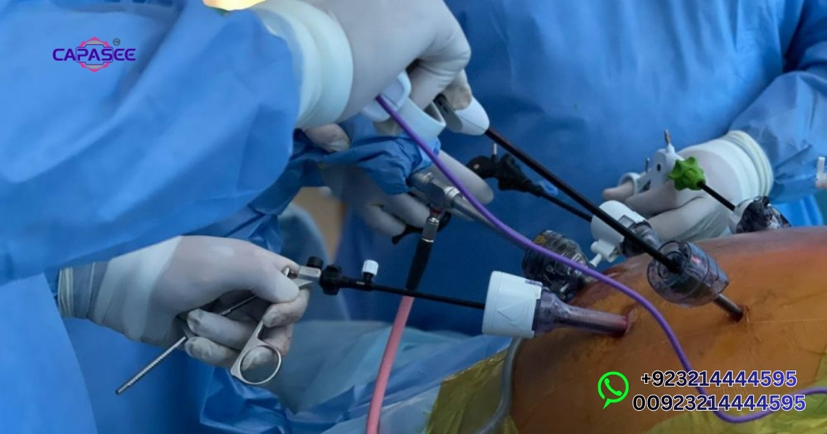 Laparoscopic Gallstone Surgery Benefits