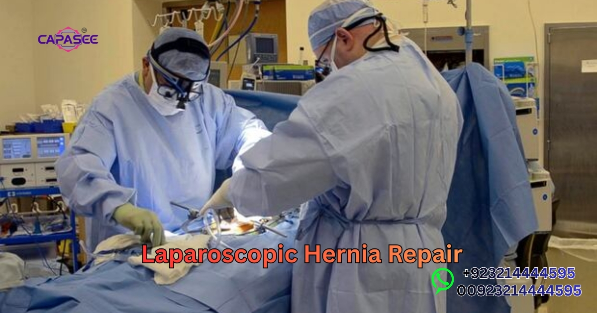 Laparoscopic Hernia Repair