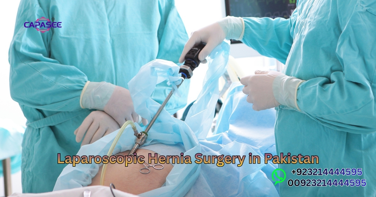 Laparoscopic Hernia Surgery in Pakistan