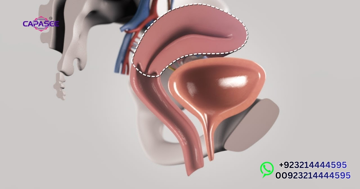 Laparoscopic Hysterectomy Recovery Time Pakistan Tips