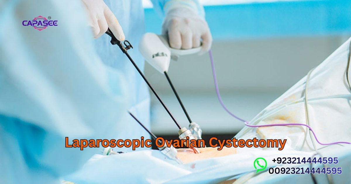 Laparoscopic Ovarian Cystectomy