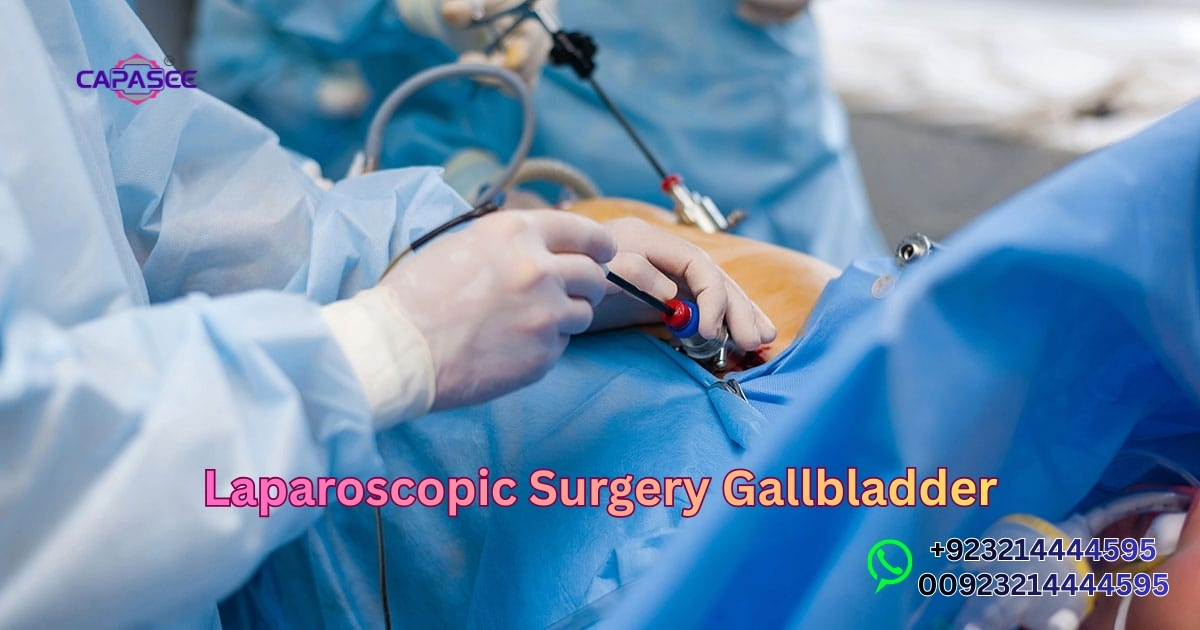 Laparoscopic Surgery Gallbladder
