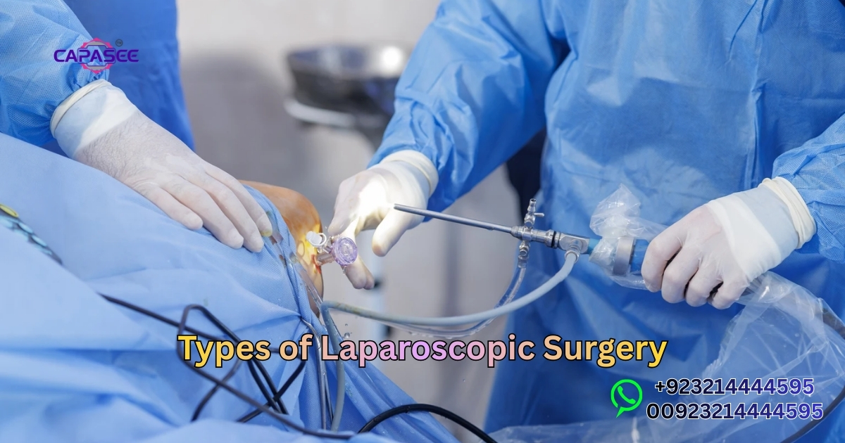 Types of Laparoscopic Surgery