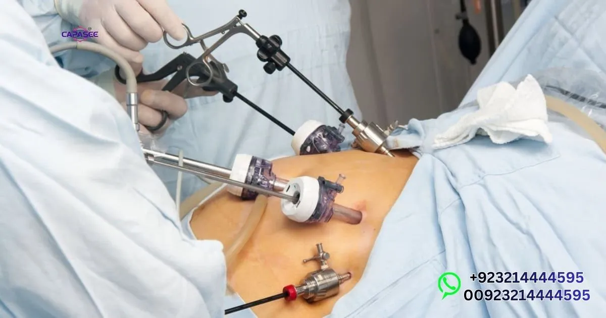 Benefits of Laparoscopic Gallbladder Surgery