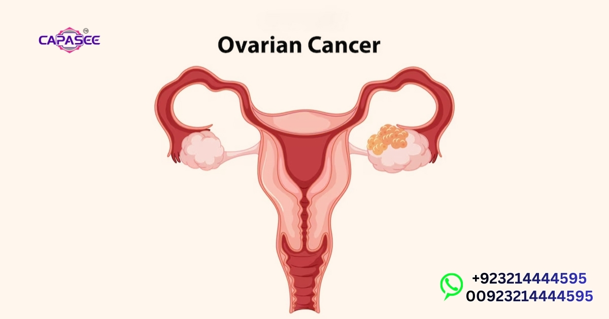 Best Laparoscopic Surgeon for Ovarian Cyst in Pakistan
