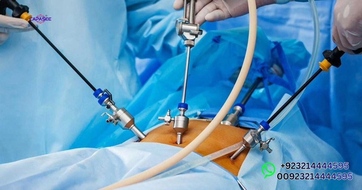 Keyhole Cholecystectomy Recovery Time in Pakistan