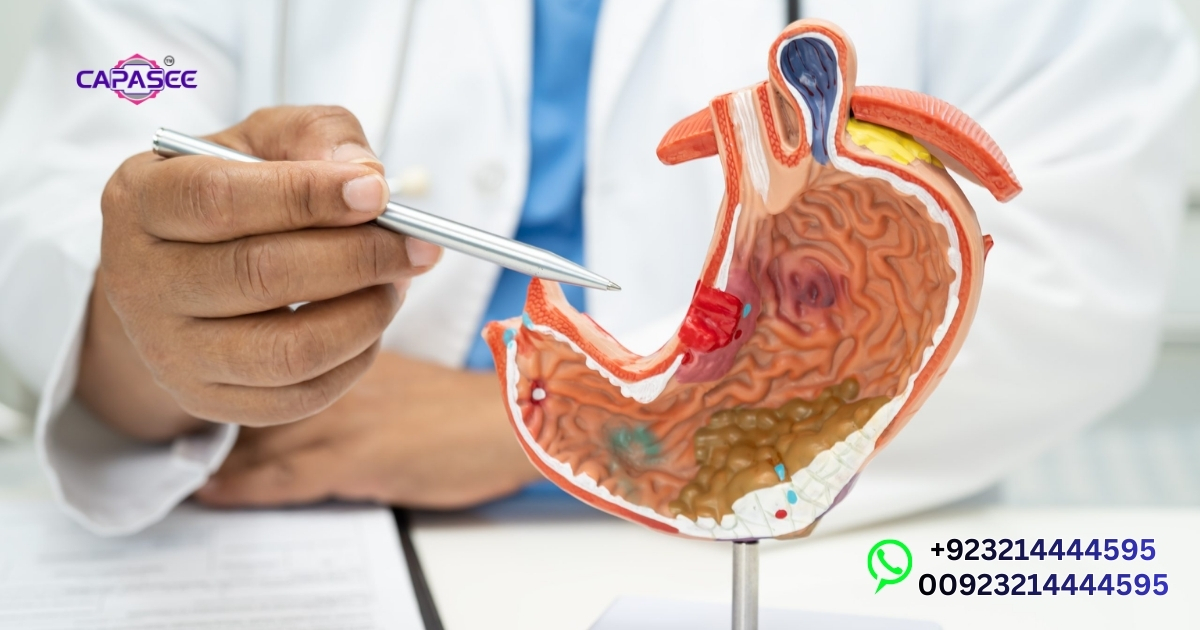 Lap Band Surgery Pakistan at Capasee