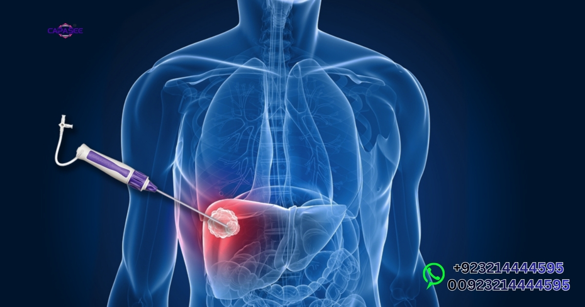 Laparoscopic Cholecystectomy Recovery Time in Pakistan