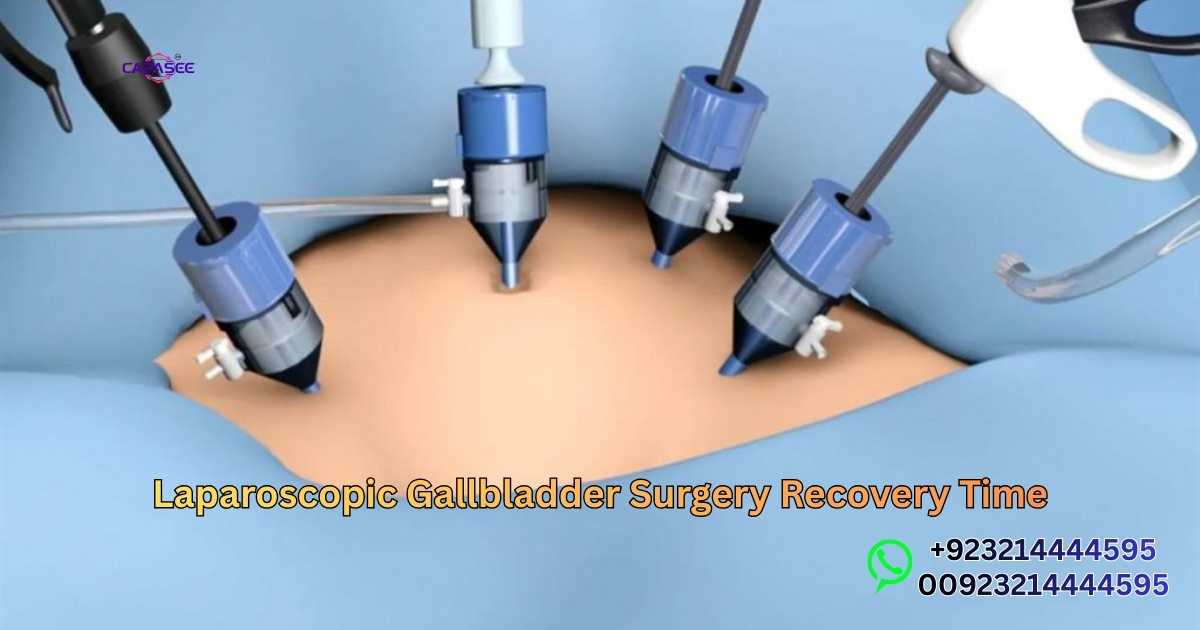 Laparoscopic Gallbladder Surgery Recovery Time
