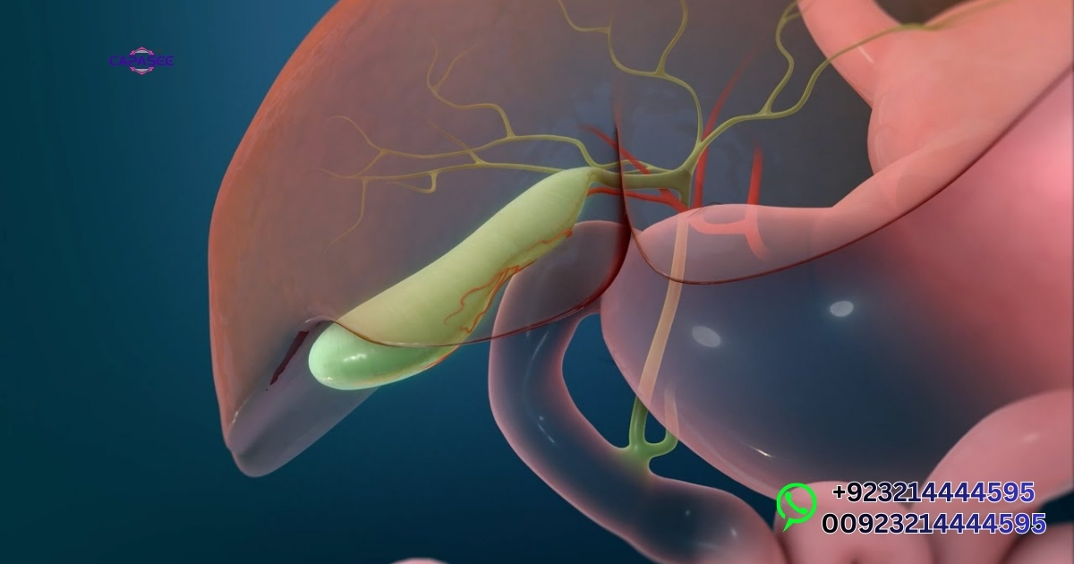 Recovery After Laparoscopic Gallbladder Surgery in Pakistan